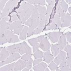 Immunohistochemical staining of human skeletal muscle shows no positivity in myocytes as expected.
