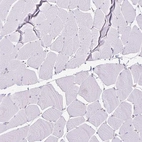 Immunohistochemical staining of human skeletal muscle shows no positivity in myocytes as expected.