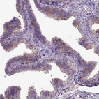 Immunohistochemical staining of human fallopian tube shows high expression.