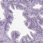 Immunohistochemical staining of human prostate shows low expression as expected.