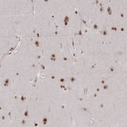 Immunohistochemical staining of human cerebral cortex shows moderate to strong nuclear positivity in neurons and glial cells.