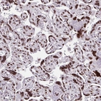 Immunohistochemical staining of human placenta shows moderate to strong nuclear positivity in trophoblastic cells.
