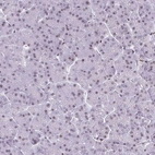 Immunohistochemical staining of human pancreas shows no positivity in exocrine glandular cells as expected.