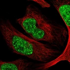 Immunofluorescent staining of human cell line U-2 OS shows localization to nuclear speckles.