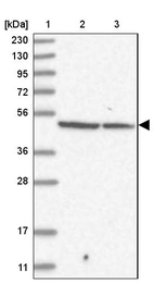 Lane 1: Marker [kDa] 230, 130, 95, 72, 56, 36, 28, 17, 11_br/_Lane 2: Human cell line RT-4_br/_Lane 3: Human cell line U-251MG sp