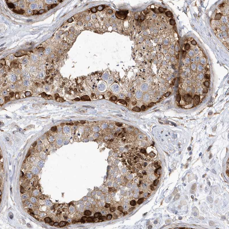 Anti-MAP7D3 Antibody