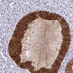Immunohistochemical staining of human cervix, uterine shows strong cytoplasmic-membranous positivity in glandular cells.