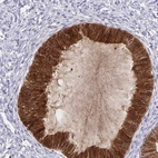Immunohistochemical staining of human cervix, uterine shows strong cytoplasmic-membranous positivity in glandular cells.