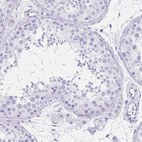 Immunohistochemical staining of human testis shows no positivity in cells in seminiferous ducts as expected.
