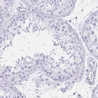 Immunohistochemical staining of human testis shows no positivity in cells in seminiferous ducts as expected.