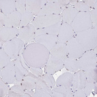 Immunohistochemical staining of human skeletal muscle shows no positivity in myocytes as expected.