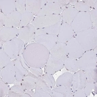 Immunohistochemical staining of human skeletal muscle shows no positivity in myocytes as expected.