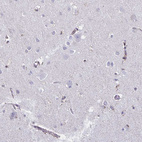 Immunohistochemical staining of human cerebral cortex shows weak cytoplasmic-membranous positivity in endothelial cells.
