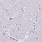 Immunohistochemical staining of human cerebral cortex shows weak cytoplasmic-membranous positivity in endothelial cells.