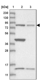 Lane 1: Marker [kDa] 230, 130, 95, 72, 56, 36, 28, 17, 11_br/_Lane 2: Human cell line RT-4_br/_Lane 3: Human cell line U-251MG sp