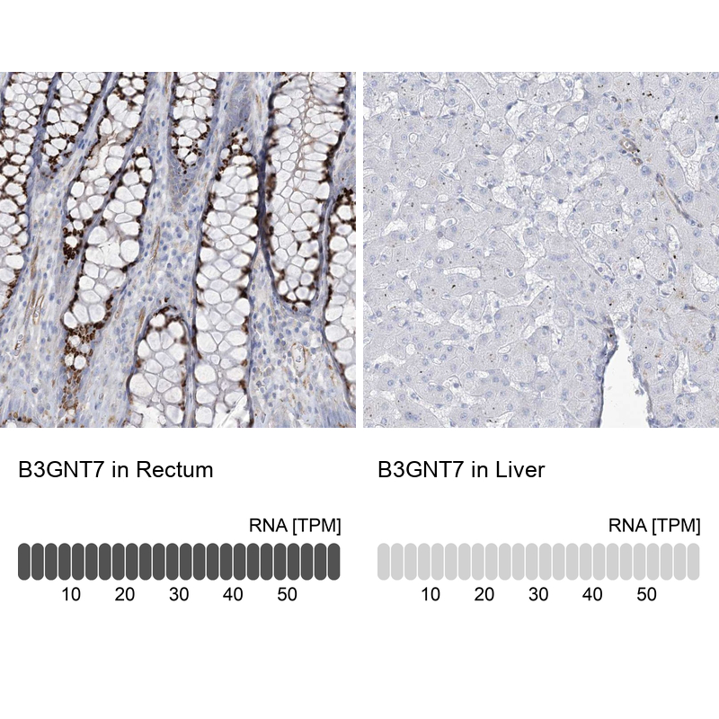 Anti-B3GNT7 Antibody