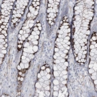 Immunohistochemical staining of human rectum shows high expression.