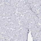 Immunohistochemical staining of human liver shows low expression as expected.
