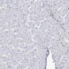 Immunohistochemical staining of human liver shows low expression as expected.