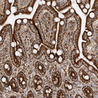 Anti-AARS2 Antibody