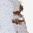Anti-PAFAH1B3 Antibody