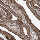 Immunohistochemical staining of human Fallopian tube shows strong granular cytoplasmic positivity in glandular cells.