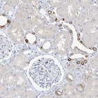 Immunohistochemical staining of human kidney shows moderate membranous positivity in cells in distal tubules.