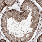 Immunohistochemical staining of human testis shows moderate to strong granular cytoplasmic positivity in cells in seminiferous ducts.