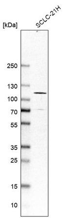 Western blot analysis in human cell line SCLC-21H.