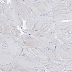 Immunohistochemical staining of human skeletal muscle shows no positivity in myocytes as expected.
