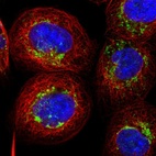 Immunofluorescent staining of human cell line A-431 shows localization to mitochondria.