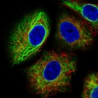 Immunofluorescent staining of human cell line A549 shows localization to intermediate filaments.