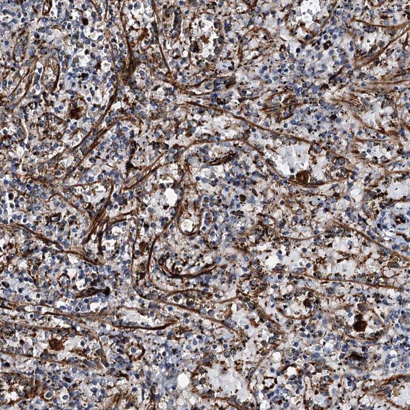Anti-DPEP2 Antibody