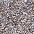 Anti-DPEP2 Antibody