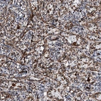 Anti-DPEP2 Antibody