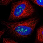 Immunofluorescent staining of human cell line U-2 OS shows localization to nucleoli.