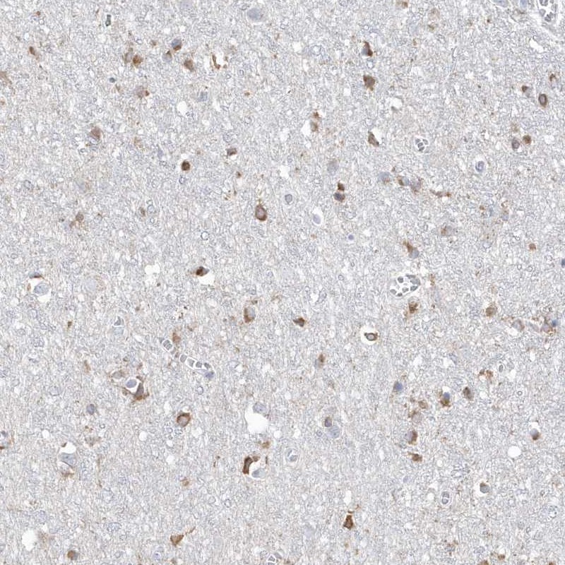 Anti-TMEM132B Antibody