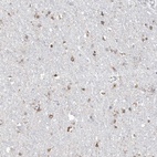 Anti-TMEM132B Antibody