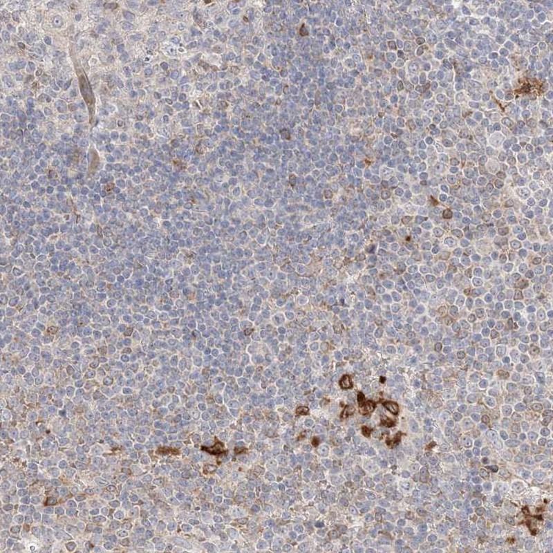 Anti-CLNK Antibody