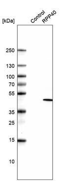 Western blot analysis in control (vector only transfected HEK293T lysate) and RPP40 over-expression lysate (Co-expressed with a C-terminal myc-DDK tag (~3.1 kDa) in mammalian HEK293T cells, LY416512).