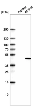 Western blot analysis in control (vector only transfected HEK293T lysate) and RPP40 over-expression lysate (Co-expressed with a C-terminal myc-DDK tag (~3.1 kDa) in mammalian HEK293T cells, LY416512).