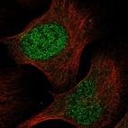 Immunofluorescent staining of human cell line U-2 OS shows localization to nucleoplasm.