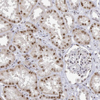 Anti-XPC Antibody