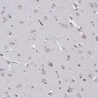 Immunohistochemical staining of human cerebral cortex shows moderate to strong nuclear positivity in glial cells.