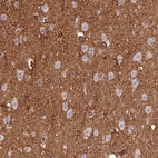 Immunohistochemical staining of human cerebral cortex shows strong positivity in neuropil and glial cells.