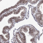 Immunohistochemical staining of human fallopian tube shows moderate to strong nuclear positivity in glandular cells.