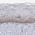Immunohistochemical staining of human cervix, uterine shows moderate to strong nuclear positivity in squamous epithelial cells.