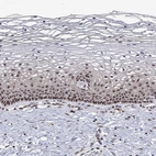 Immunohistochemical staining of human cervix, uterine shows moderate to strong nuclear positivity in squamous epithelial cells.