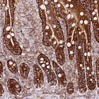Immunohistochemical staining of human duodenum shows strong membranous positivity in glandular cells.