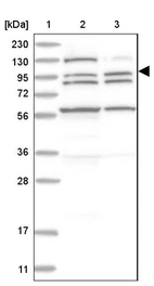 Lane 1: Marker [kDa] 230, 130, 95, 72, 56, 36, 28, 17, 11_br/_Lane 2: Human cell line RT-4_br/_Lane 3: Human cell line U-251 MG